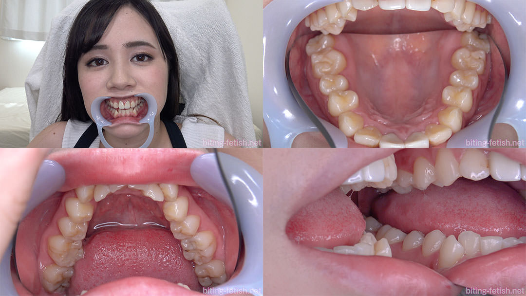 【歯フェチ】吉川あいみちゃんの歯を観察しました！