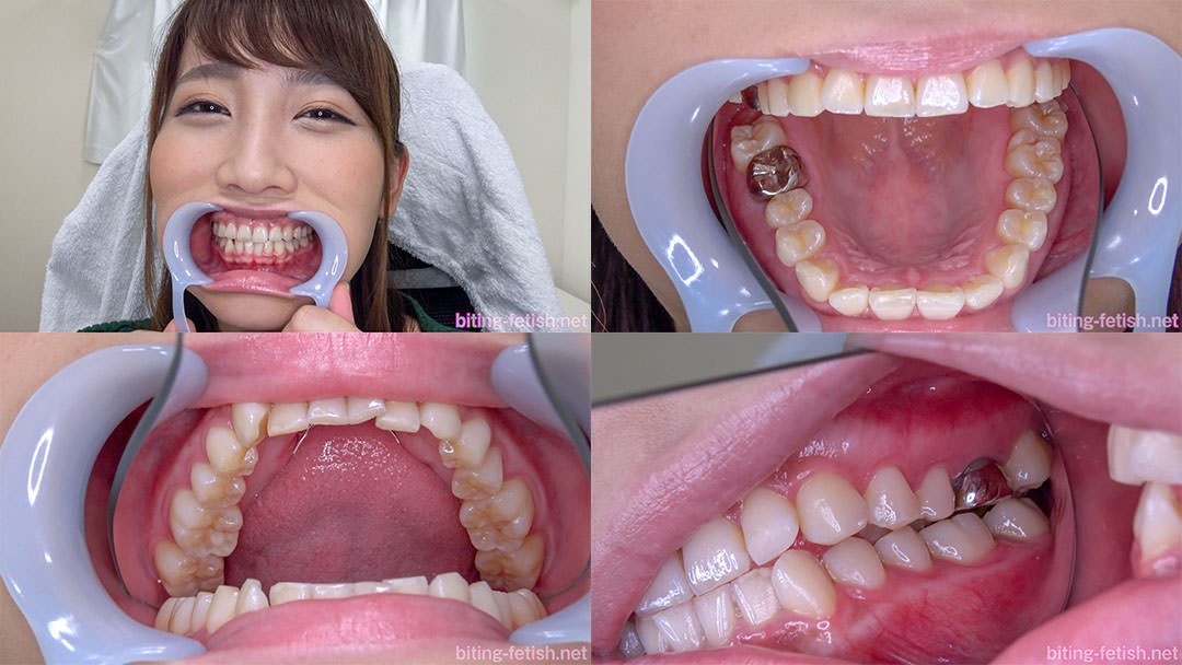 【歯フェチ】倉多まおちゃんの歯を観察しました！