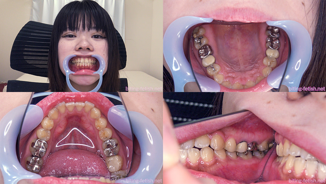 【歯フェチ】成田まつり女王様の歯を観察させていただきました！