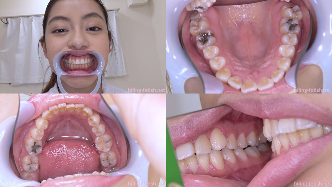 【歯フェチ】桜庭ひかりちゃんの歯を観察しました！
