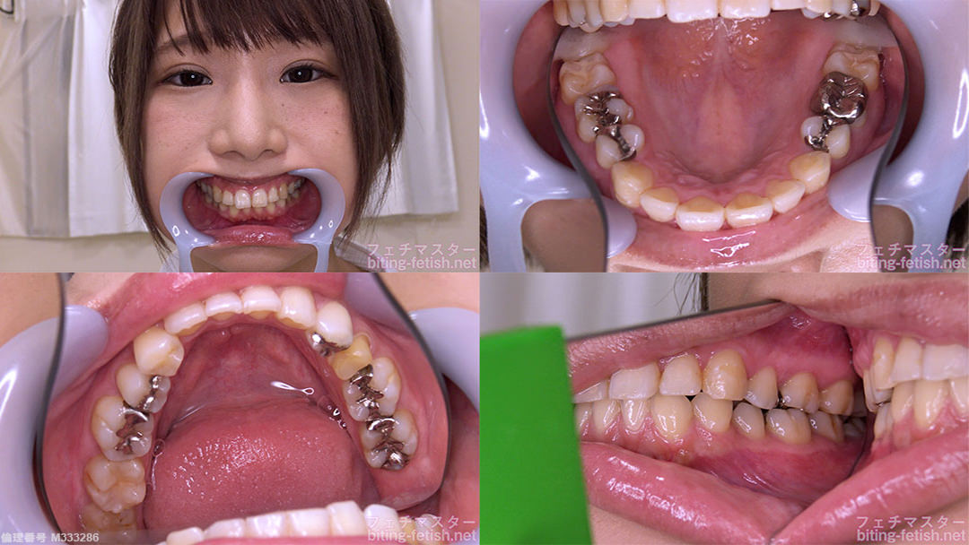【歯フェチ】乙アリスちゃんの歯を観察しました！