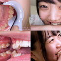 【特典動画付】水卜麻衣奈の歯と噛みつきシリーズ1～2まとめてDL