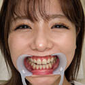 【歯フェチ】永瀬ゆいちゃんの歯を観察しました！