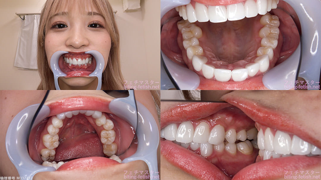 【歯フェチ】栄川乃亜ちゃんの歯を観察しました！