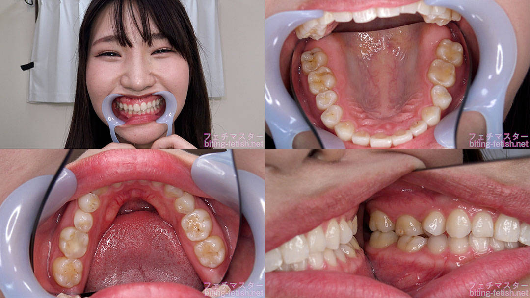 【歯フェチ】志恩まこちゃんの歯を観察しました！