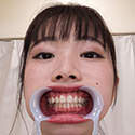 【歯フェチ】美波こづえちゃんの歯を観察しました！