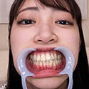 【歯フェチ】加賀美さらちゃんの歯を観察しました！