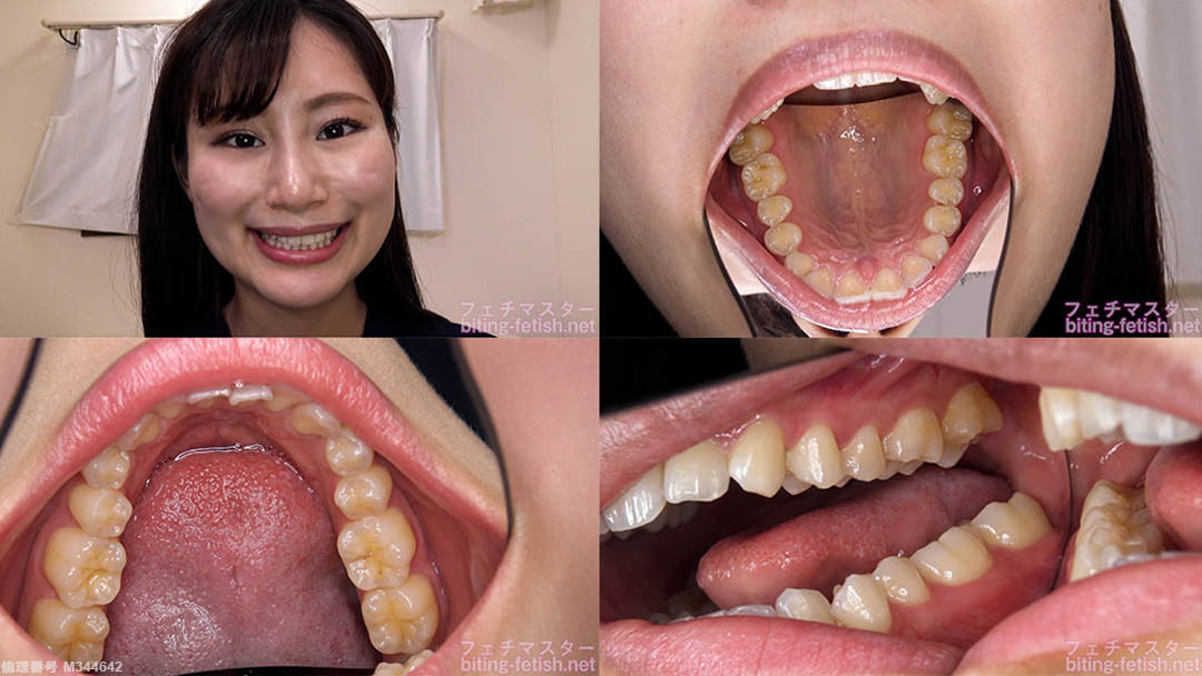 【歯フェチ】堀内美香ちゃんの歯を観察しました！