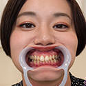【歯フェチ】平井栞奈さんの歯を観察しました！