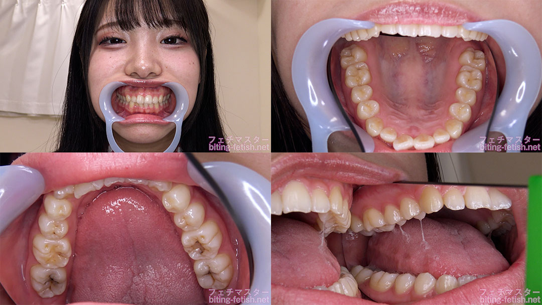 【歯フェチ】鈴音杏夏ちゃんの歯を観察しました！