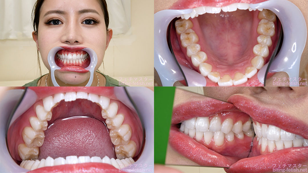 【歯フェチ】永井マリアさんの歯を観察しました！