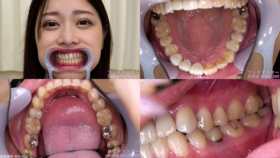 【歯フェチ】野咲美桜さんの歯を観察しました！