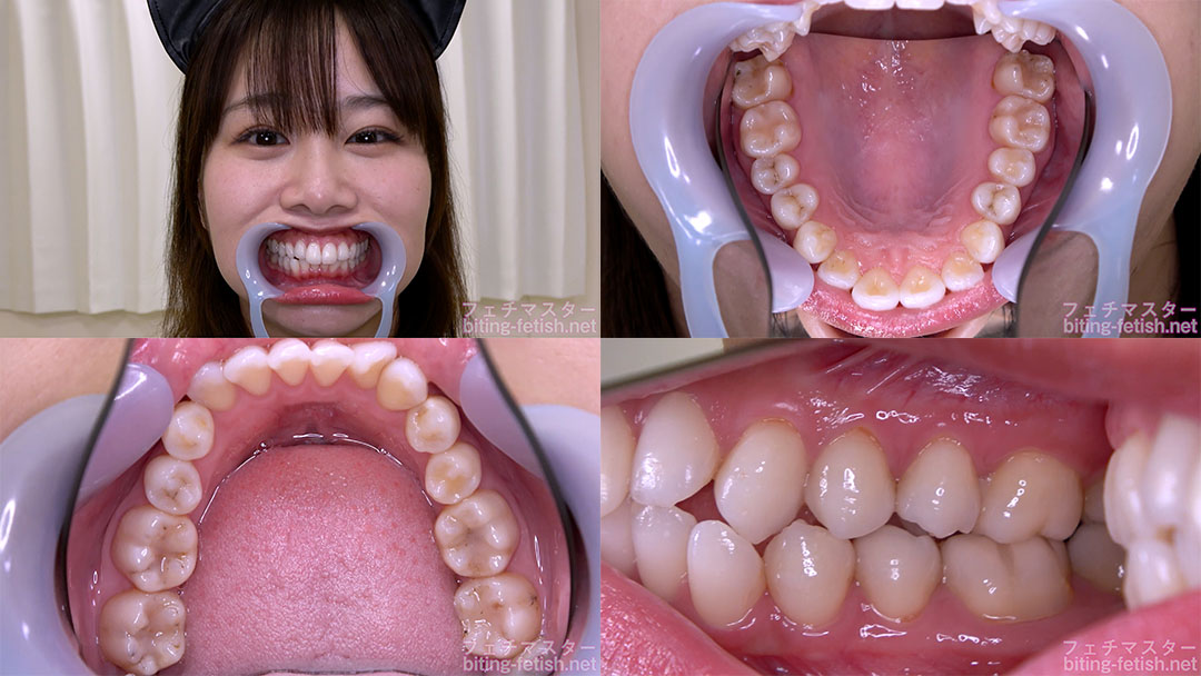 【歯フェチ】北村海智ちゃんの歯を観察しました！