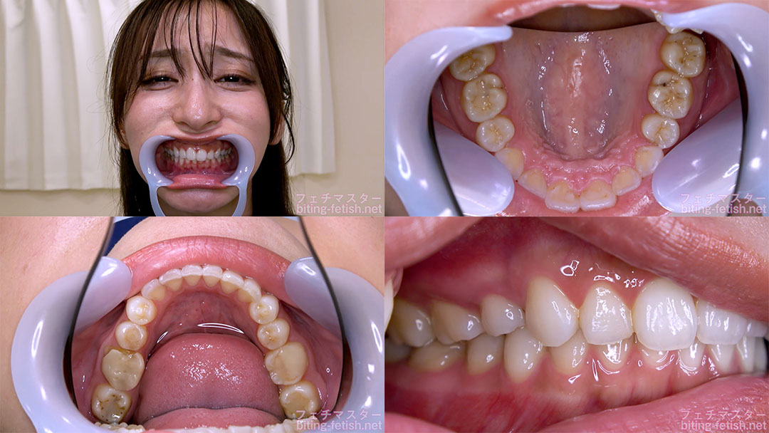 【歯フェチ】足立友梨さんの歯を観察しました!