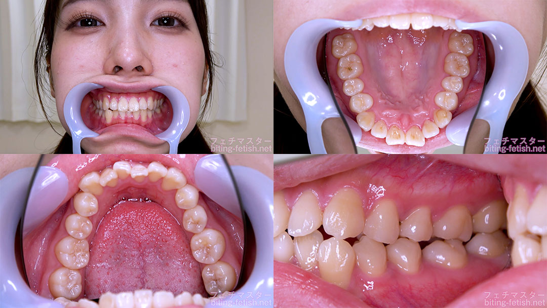 【歯フェチ】花里アカリちゃんの歯を観察しました!
