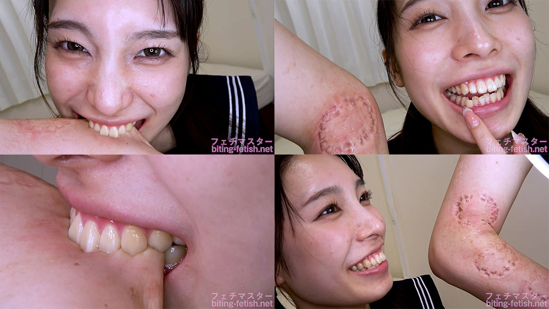 【噛みつき】深~い歯形!かわいい花里アカリちゃんの容赦ない本気噛み 前編