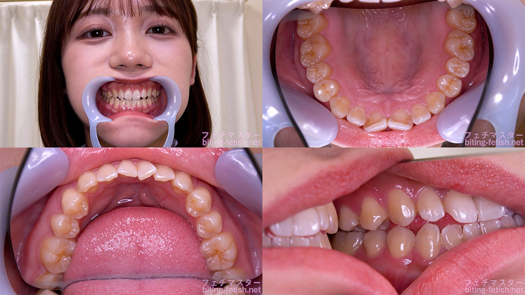 【歯フェチ】小野寺舞ちゃんの歯を観察しました!