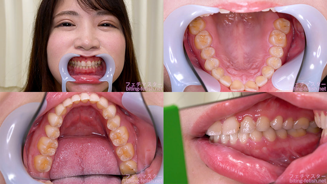 【歯フェチ】秋月まりなちゃんの歯を観察しました!
