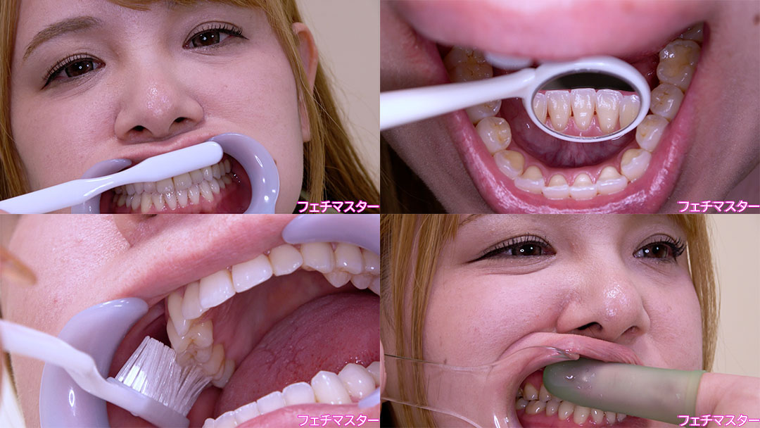 【歯フェチ】特別企画! 西村ニーナさんの歯をデンタルミラーで観察&開口器着けながら歯磨き&口角鉤着けながら指歯ブラシ