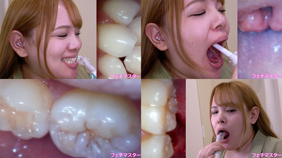 【歯フェチ】特別企画! 西村ニーナさんの歯・口内・喉奥を歯科用カメラで観察