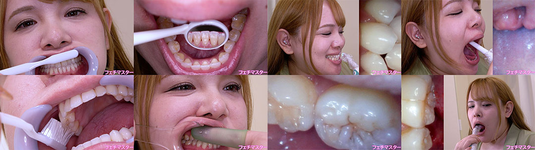 西村ニーナの歯観察 特別企画シリーズ1～2まとめてDL