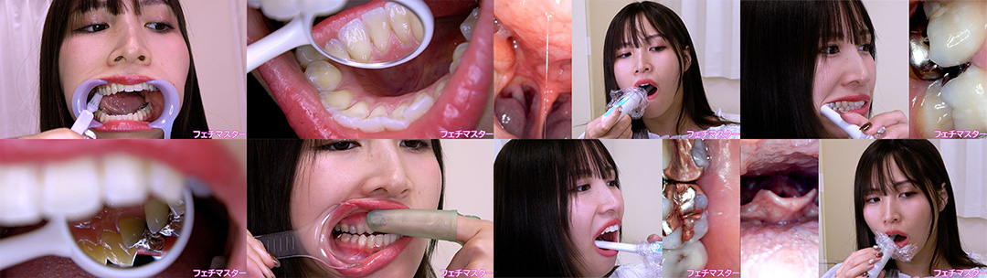 南條彩の歯観察 特別企画シリーズ1～2まとめてDL