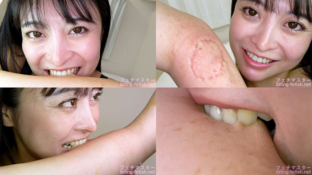 【噛みつき】歯並び抜群！うるるさんの本気噛み 前編【潤うるる】