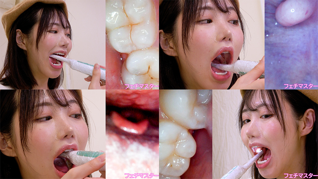 【歯フェチ】特別企画! 琥珀ややさんの歯・口内・喉奥を歯科用カメラで観察