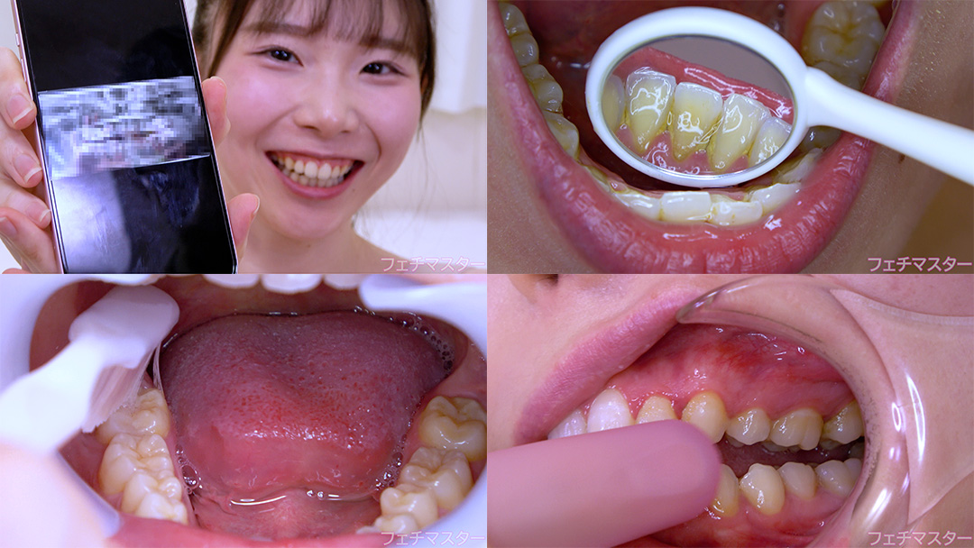 【歯フェチ】特別企画！ 藤田ゆずさんの歯をデンタルミラーで観察&開口器着けながら歯磨き&口角鉤着けながら指歯ブラシ レントゲン写真もあり！
