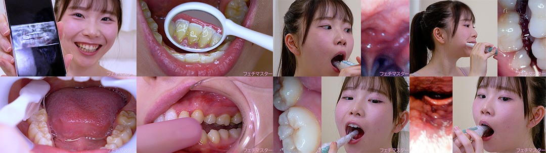 藤田ゆずの歯観察 特別企画シリーズ1～2まとめてDL