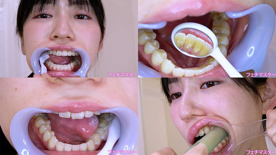 【歯フェチ】特別企画! 塩見彩さんの歯をデンタルミラーで観察&開口器着けながら歯磨き&口角鉤着けながら指歯ブラシ